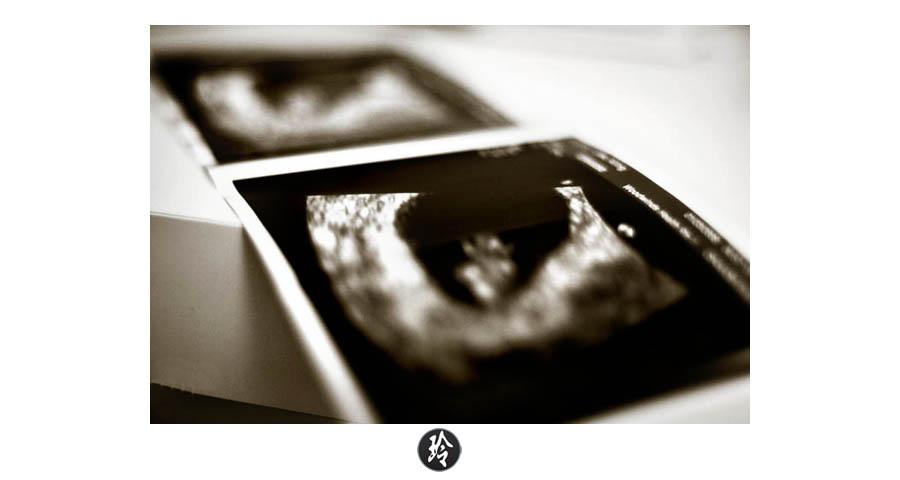 ultrasound